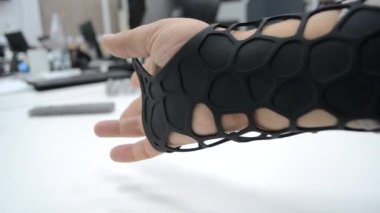 Siyah ortopedik plastik protez, elindeki toz 3D yazıcıya basılmış..