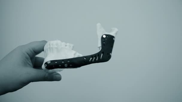 Person holds in his hand an example of an artificial jaw printed — Stock Video