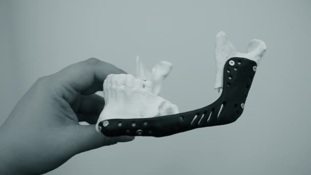 Persona sosteniendo en la mano endoprosthese mandibular facial impresa impresora 3D de metal — Vídeos de Stock