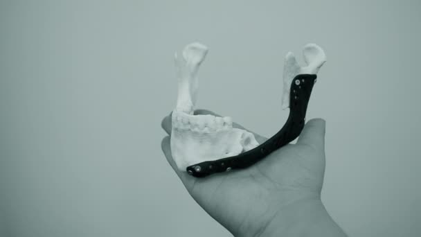 Pessoa segurando na mão endopróteses mandibulares faciais impressas impressora 3D de metal — Vídeo de Stock