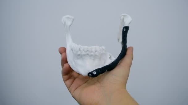 Persona sosteniendo en la mano endoprosthese mandibular facial impresa impresora 3D de metal — Vídeo de stock