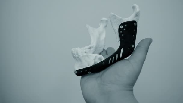 Person holding in hand facial mandibular endoprosthese printed metal 3D printer — Stock Video