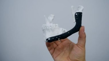 Elinde yüz çene kemiğini tutan kişi bu yazdırılmış metal 3D yazıcıyı çalıştırıyor.