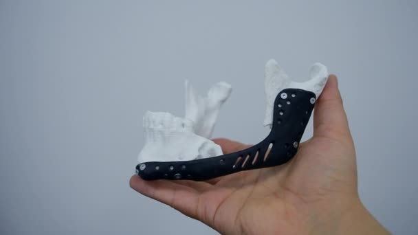 Persona sosteniendo en la mano endoprosthese mandibular facial impresa impresora 3D de metal — Vídeo de stock