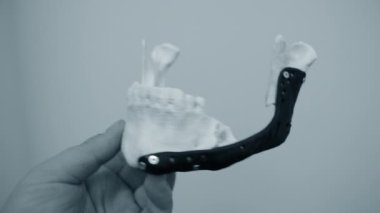 Elinde yüz çene kemiğini tutan kişi bu yazdırılmış metal 3D yazıcıyı çalıştırıyor.