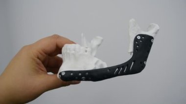Elinde yüz çene kemiğini tutan kişi bu yazdırılmış metal 3D yazıcıyı çalıştırıyor.
