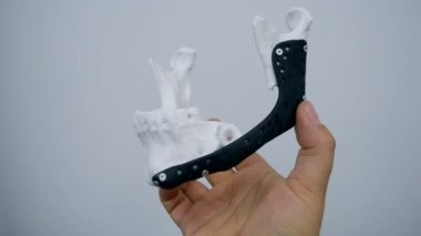 Elinde yüz çene kemiğini tutan kişi bu yazdırılmış metal 3D yazıcıyı çalıştırıyor.
