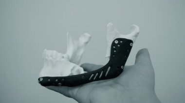 Elinde yüz çene kemiğini tutan kişi bu yazdırılmış metal 3D yazıcıyı çalıştırıyor.