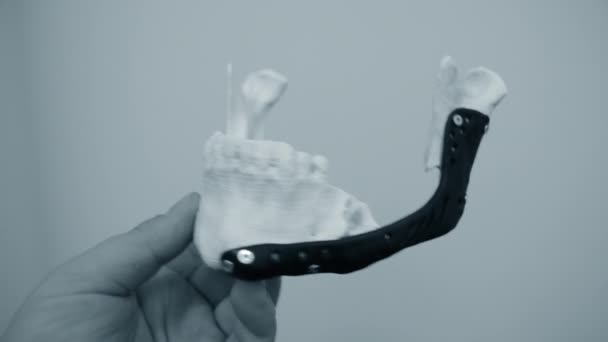 Orang yang memegang di tangan endoprosthese mandibular dicetak logam 3D printer — Stok Video