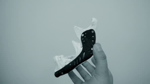 Osoba držící v ruce mandibulární endoprosthese tištěný kov 3D tiskárna — Stock video