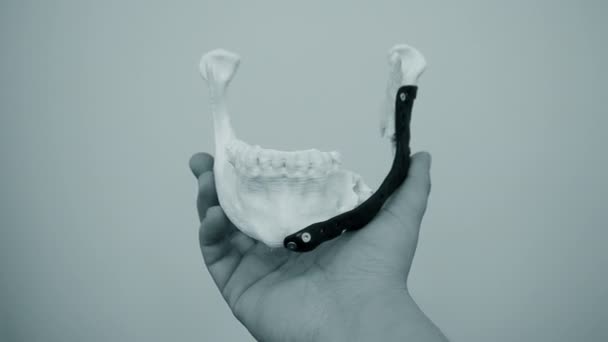 Homem segurando implante de endoprótese de mandíbula inferior. — Vídeo de Stock