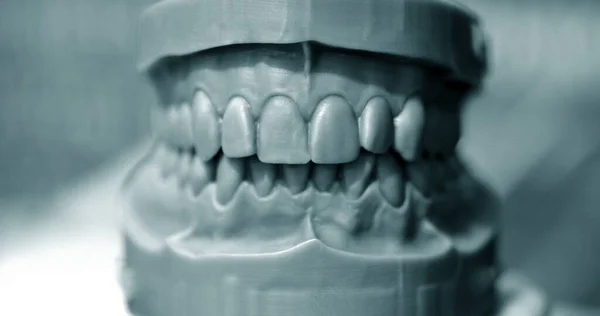 Верхняя и нижняя челюсть человека напечатана на 3D принтере фотополимера. — стоковое фото