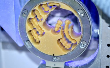 Diş değirmeni makinesi insan dişlerini oyuyor.