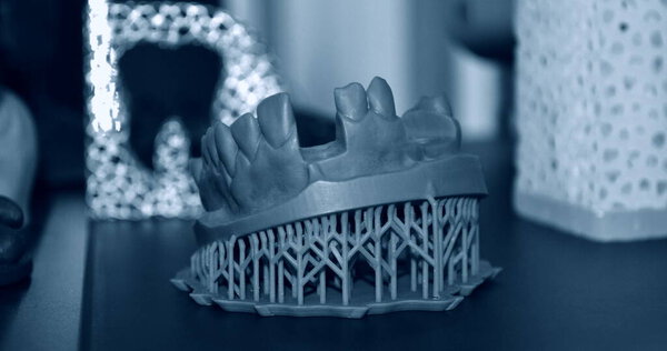 Human lower jaw printed on 3d printer of photopolymer
