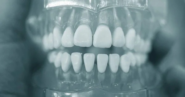 Model of human teeth of the human jaw close-up — Stock Photo, Image