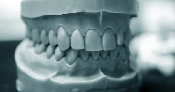 Upper and lower jaw of a man printed on a 3d printer of photopolymer — Stock Photo, Image