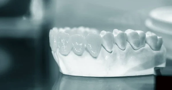 Yapay dişli insan dişi modeli. — Stok fotoğraf