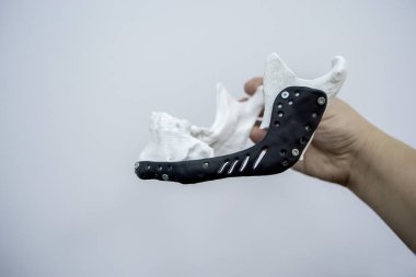 Elinde yüz çene kemiğini tutan kişi bu yazdırılmış metal 3D yazıcıyı çalıştırıyor.