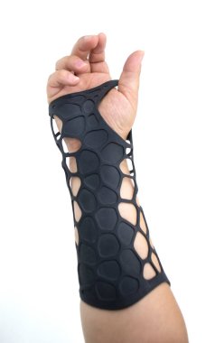 Toz 3D yazıcıya basılmış ortopedik plastik protez beyaz arka planda izole edilmiş. Alçıtaşı yakın plan. Multi Jet Füzyon MJF 3D baskı teknolojisi. Modern yenilikçi katkı teknolojisi.