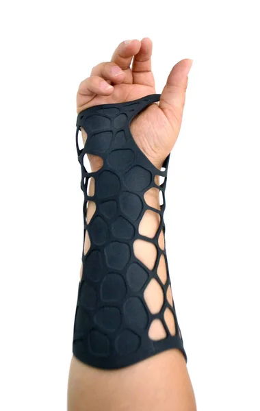 Prothèse Orthopédique Plastique Imprimée Sur Une Imprimante Poudre Isolée Main — Photo