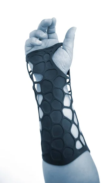 Protesi Ortopedica Plastica Stampata Stampante Polvere Portata Mano Isolato Sfondo — Foto Stock