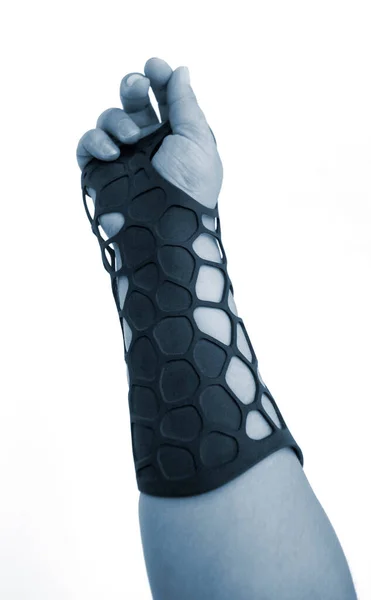 Orthopedische Plastic Prothese Gedrukt Poeder Printer Bij Hand Geïsoleerd Witte — Stockfoto