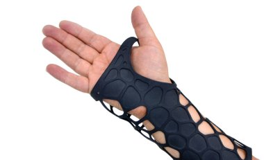 Toz 3D yazıcıya basılmış ortopedik plastik protez. Beyaz arka planda izole edilmiş. Alçıtaşı yakın plan. Multi Jet Füzyon MJF 3D baskı teknolojisi. Modern yenilikçi katkı teknolojisi
