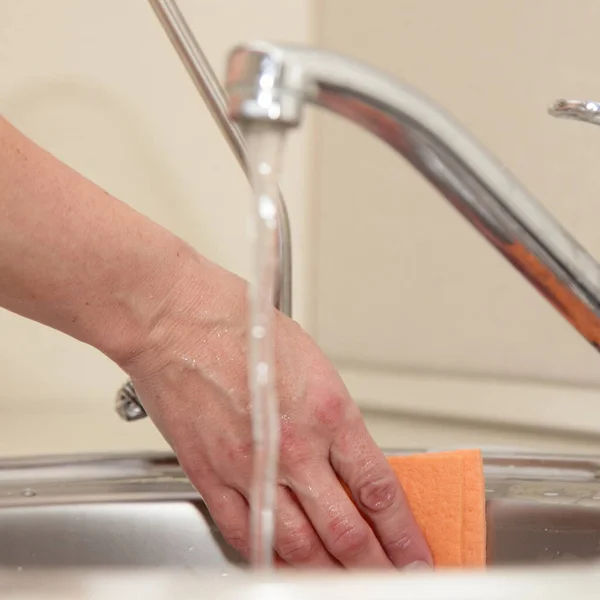 Jet Water Kitchen Faucet White Female Hand Reddened Skin Cleaning — Stock Photo, Image