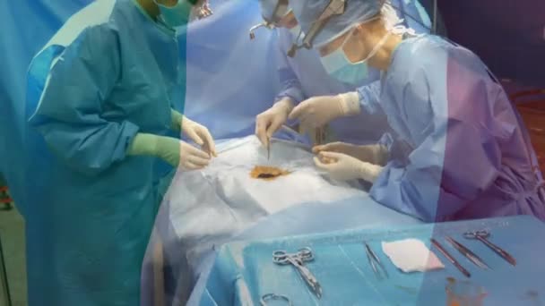 手术室手术时 在外科医生上方升起白内障旗 全球医学 围产期保健服务 数码制作的19种流行病概念视频 — 图库视频影像