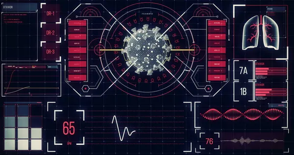 用医学信息记录在屏幕上分析巨细胞Coronavirus Covid 19细胞的图像 Global Medicine Coronavirus Covid Pandemic Concept Digital — 图库照片