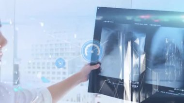 Kafkasyalı doktorun X-ray 'i incelediği ağların animasyonu. küresel tıp, sağlık ve teknoloji konsepti dijital olarak üretilen video.