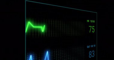 Siyah arkaplandaki kardiyografın animasyonu. küresel tıp ve dijital arayüz kavramı dijital olarak üretilen video.