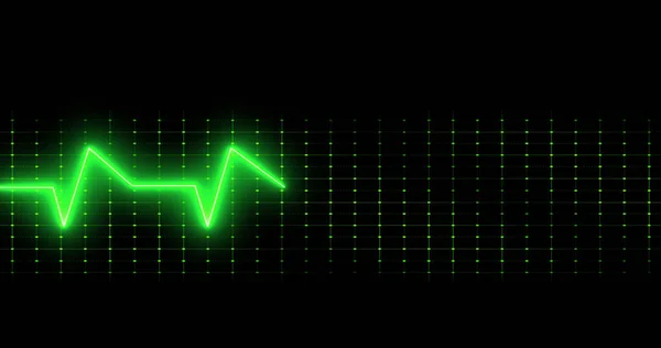 Image Cardiographe Sur Fond Noir Médecine Globale Concept Interface Numérique — Photo