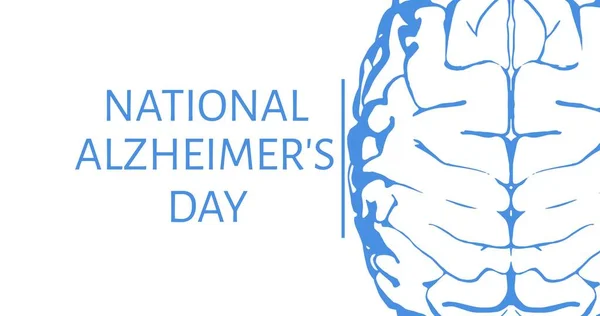 Illustratief Beeld Van Menselijk Brein Wereld Alzheimer Dagtekst Witte Achtergrond — Stockfoto