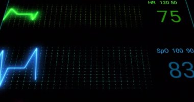 Siyah arkaplandaki kardiyografın animasyonu. Sağlık, zindelik ve dijital arayüz kavramı dijital olarak oluşturulmuş video.
