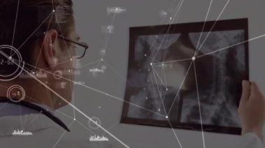 Kafkasyalı erkek doktor ve röntgen üzerinde bağlantı ağının animasyonu. küresel bilim ve dijital arayüz kavramı dijital olarak oluşturulmuş video.
