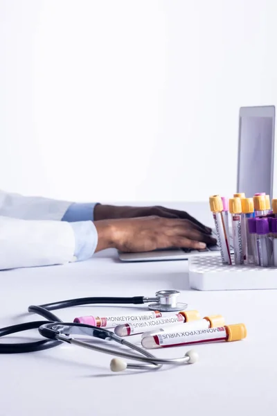 Vials Monkeypox Virus Stethoscope African American Male Doctor Using Laptop — Stock Photo, Image