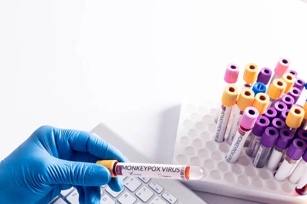 Hand Doctor Holding Vial Monkeypox Virus Keyboard Monkeypox Virus Medical —  Fotos de Stock