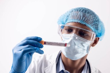 Yüz maskesi takan Afro-Amerikan erkek doktor elinde maymun çiçeği virüsü şişesi tutuyor. Maymun Çiçeği virüsü, tıbbi araştırma ve sağlık hizmetleri.