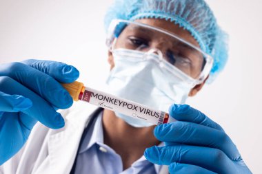 Yüz maskesi takan Afro-Amerikan erkek doktor elinde maymun çiçeği virüsü şişesi tutuyor. Maymun Çiçeği virüsü, tıbbi araştırma ve sağlık hizmetleri.