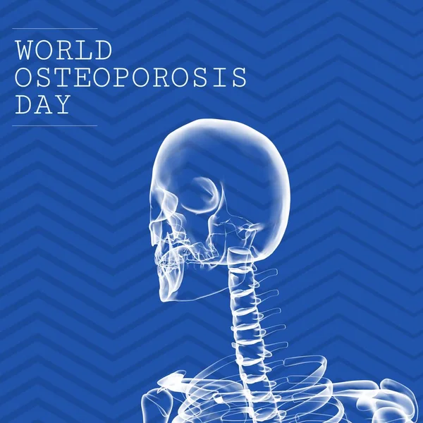 Composition World Osteoporosis Day Text Digital Skeleton Blue Background World — 스톡 사진