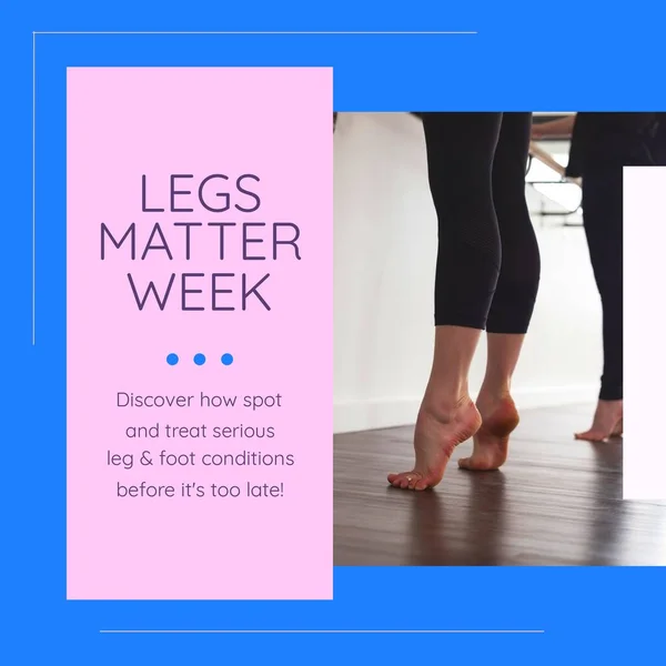 Composition Legs Matter Week Text Diverse Ballet Dancers Legs Matter — Stock Photo, Image