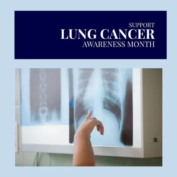 Bild Des Bewusstseinskonzepts Für Lungenkrebs Über Den Händen Eines Kaukasischen — Stockfoto