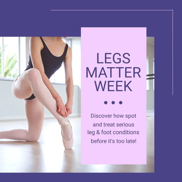 Composition Legs Matter Week Text Caucasian Ballet Dancer Legs Matter — Fotografia de Stock