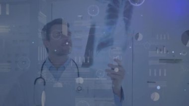Animation of connections and graphs over caucasian male doctor with x ray photo. Health, medicine, connections and technology concept digitally generated video.