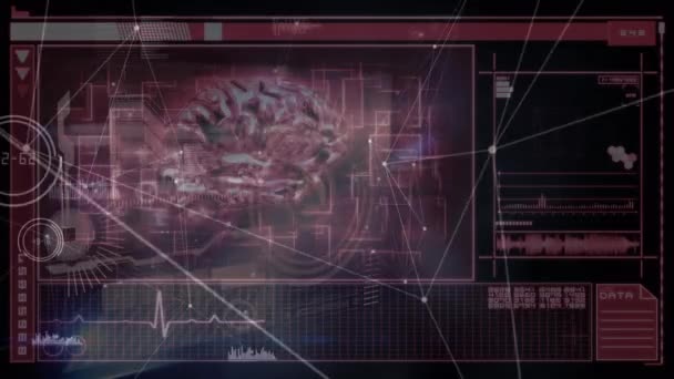 Animation Network Connections Medical Data Processing Human Brain Global Medicine — Video