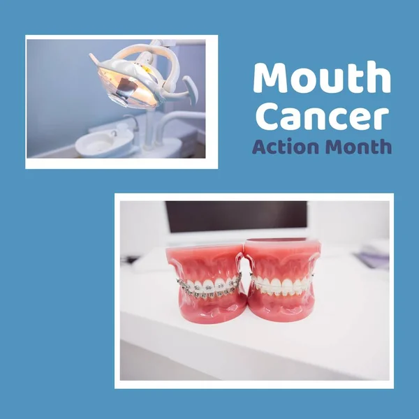 Lighting equipment, dentures at dentist\'s office with mouth cancer action month text, copy space. Digital composite, oral health, healthcare, raise awareness, early detection and prevention.