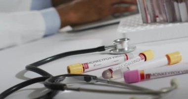 Maymun çiçeği virüsü ve steteskoplu şişeler, dizüstü bilgisayar kullanan Afro-Amerikan erkek doktor üzerinde. Maymun Çiçeği virüsü, tıbbi araştırma ve sağlık hizmetleri.