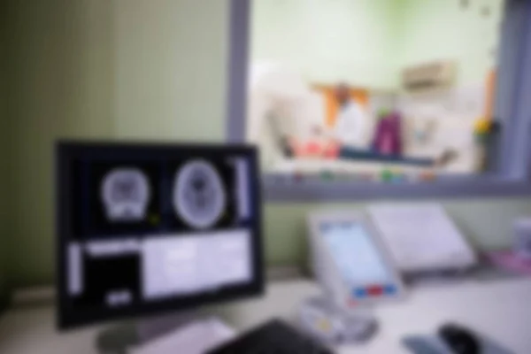 Blurry Digital Brain Scan Computer Monitor — Stok fotoğraf