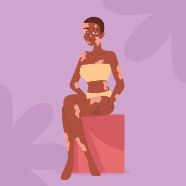 Vitiligo pigmentasyonu ve tasarımı olan genç bir kadın.